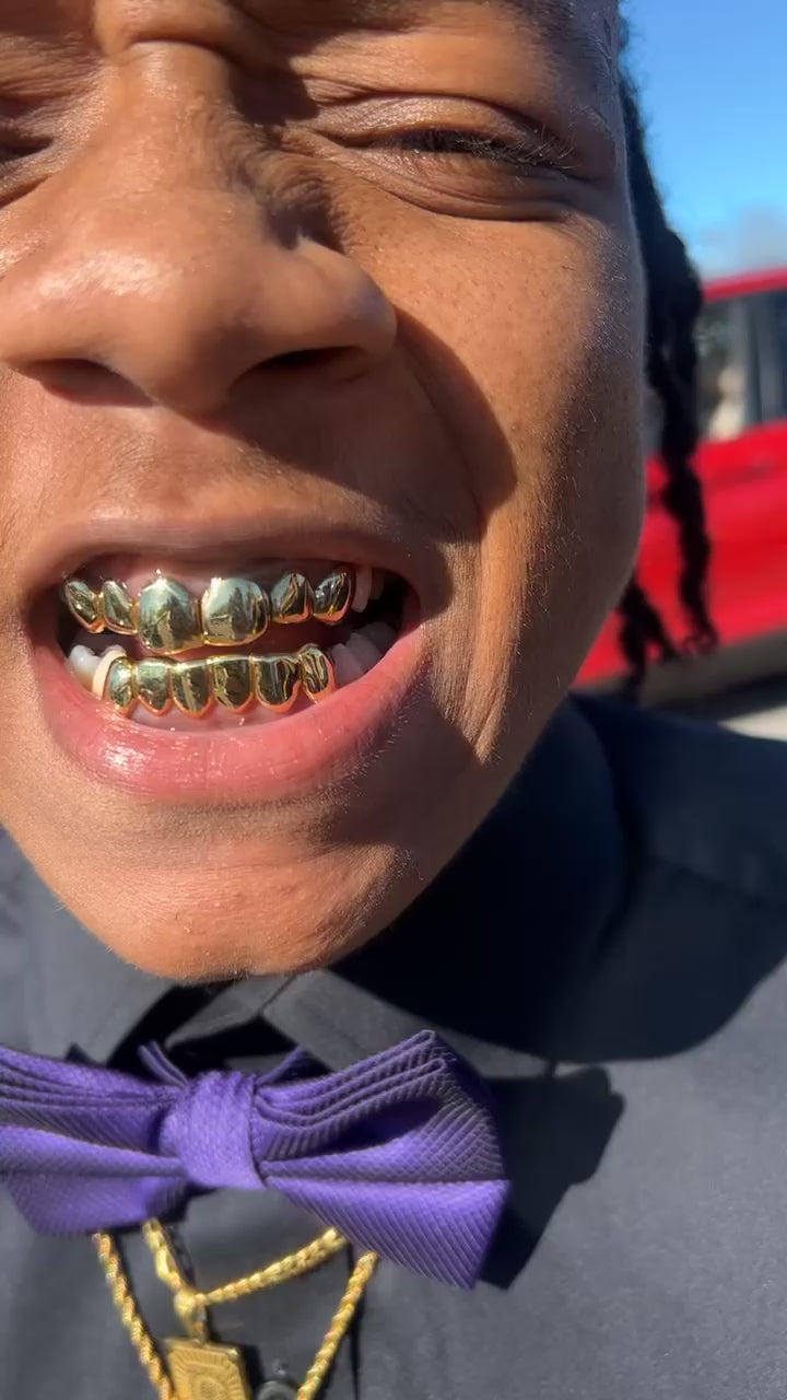 10k (NPG) Perm Cut Grillz
